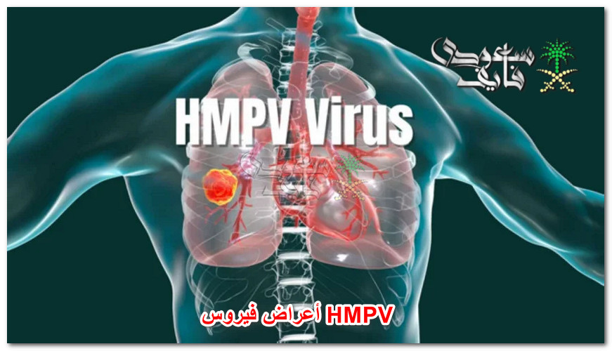 الزعر يصيب العالم.. أبرز الفروقات بين أعراض فيروس HMPV وكورونا والإنفلونزا