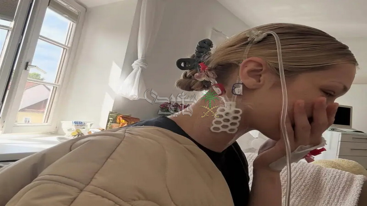 ما هو مرض بيلا حديد؟.. رحلة معاناة خلف بريق الأضواء