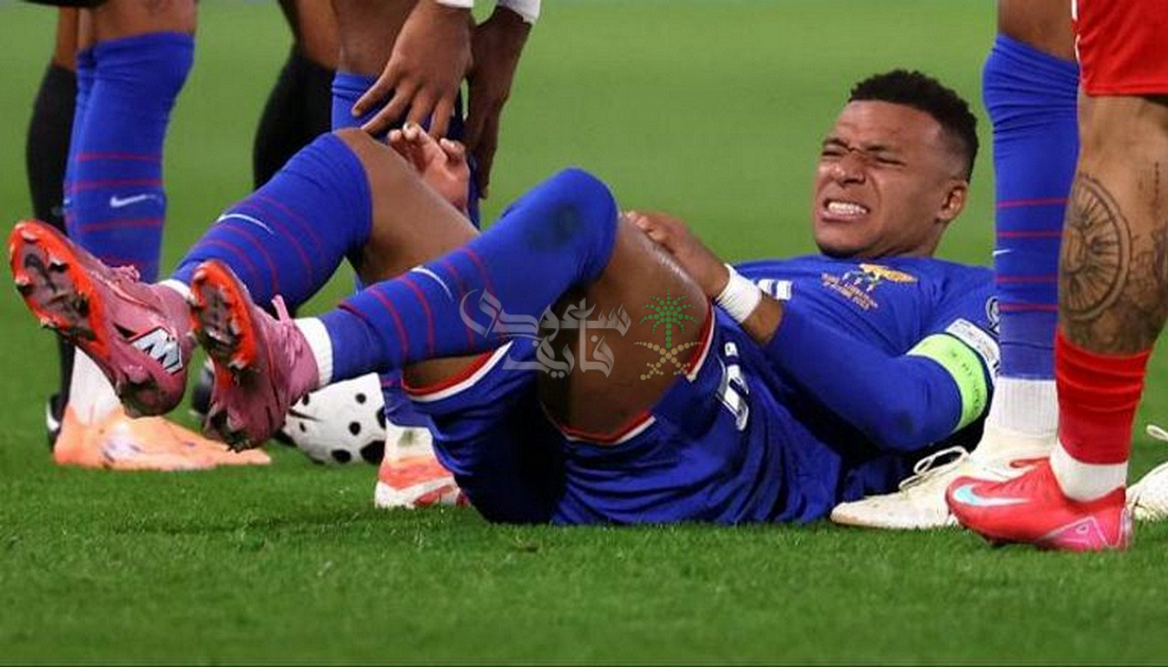 تشخيص إصابة كيليان مبابي