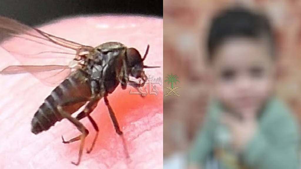 وفاة طفل أردني بلدغة ذبابة الرمل السوداء.. وتحذيرات من خطرها القاتل