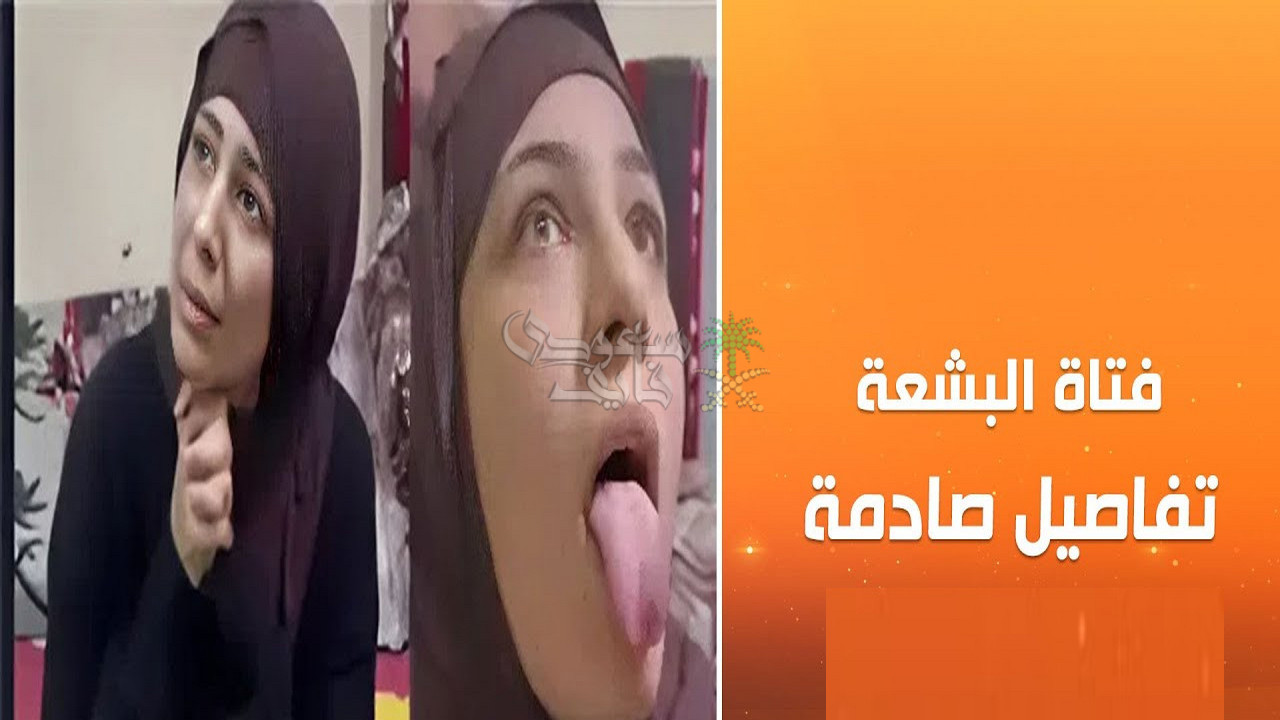 قصة فتاة البشعة.. كيف تحوّل مقطع صادم إلى قضية رأي عام؟
